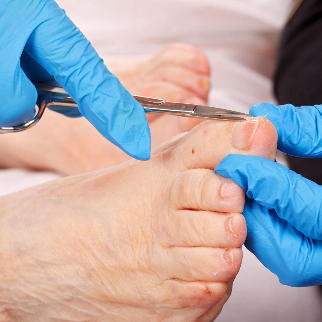 5 steps to better foot health for Seniors