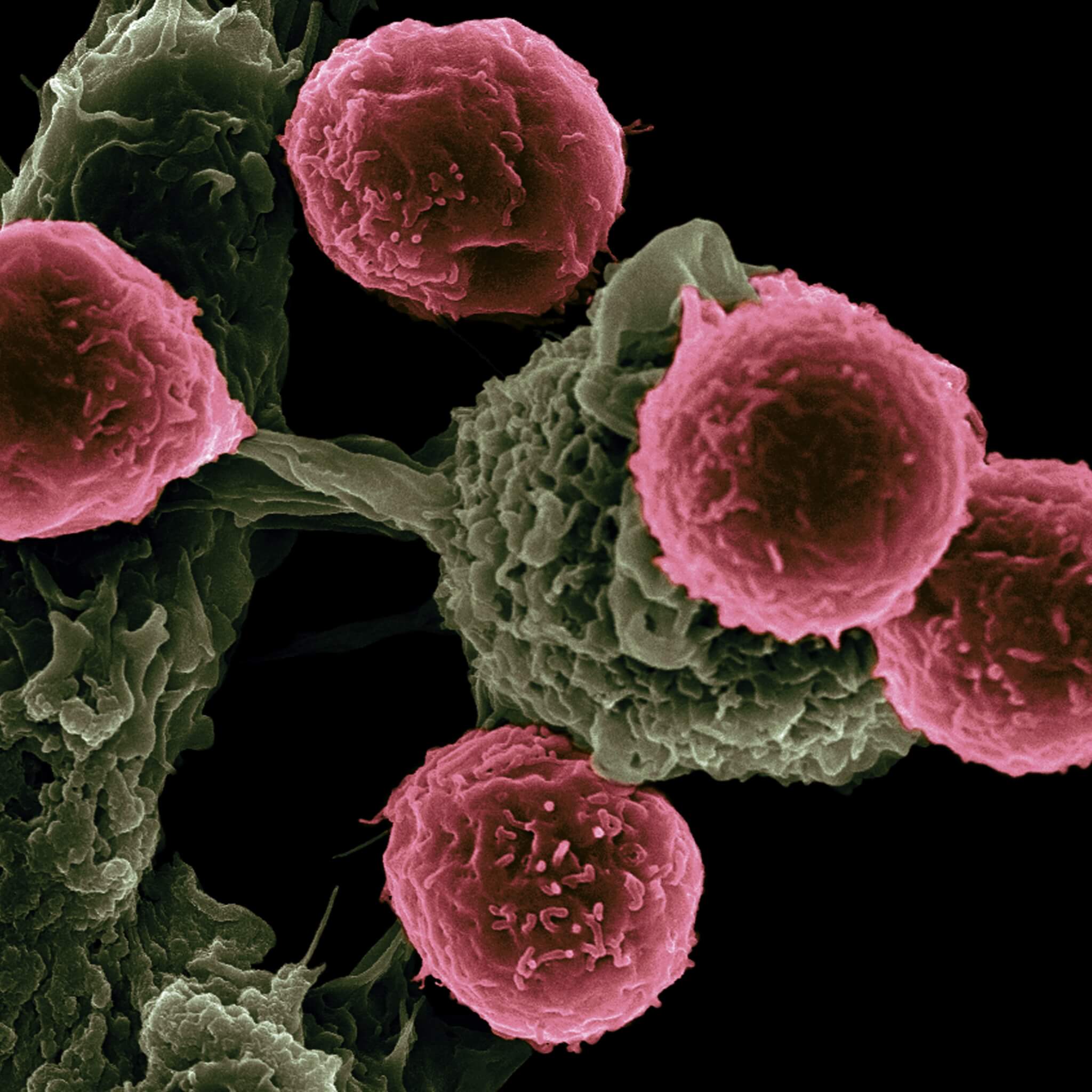 Microscopic view of pink-colored immune cells attached to a textured green surface against a black background. - Home Instead