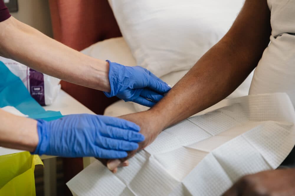 shingles in the elderly